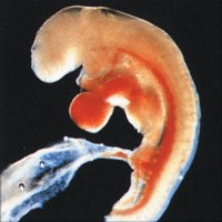 Három hetes embrió