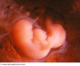 Négy hetes embrió